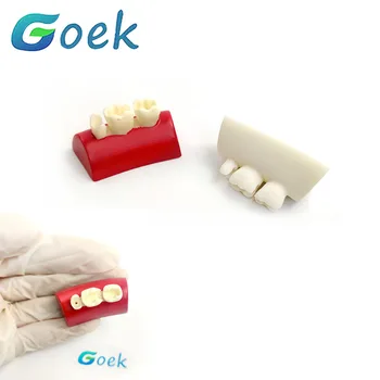 Зубной блок из смолы для наполнения, Упражнение с инкрустацией, Упражнение с моделью, Красно-Белый Инструмент для стоматологических материалов